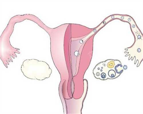 27岁卵巢功能早衰症状&金贝供卵联系方式,不孕